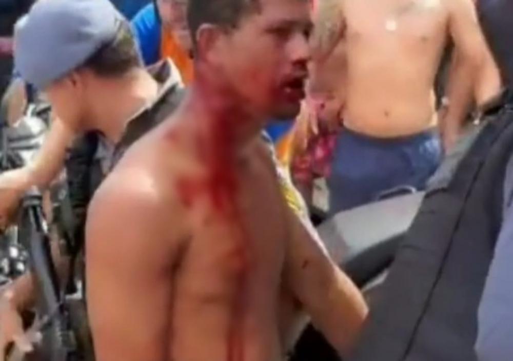 Polícia salva homem que levou surra da população após roubar no bairro Mutirão