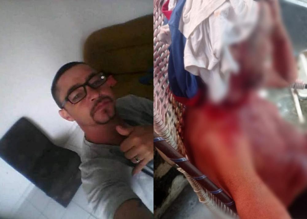 Filho agride e quebra a cabeça do pai que se negou a emprestar dinheiro a ele