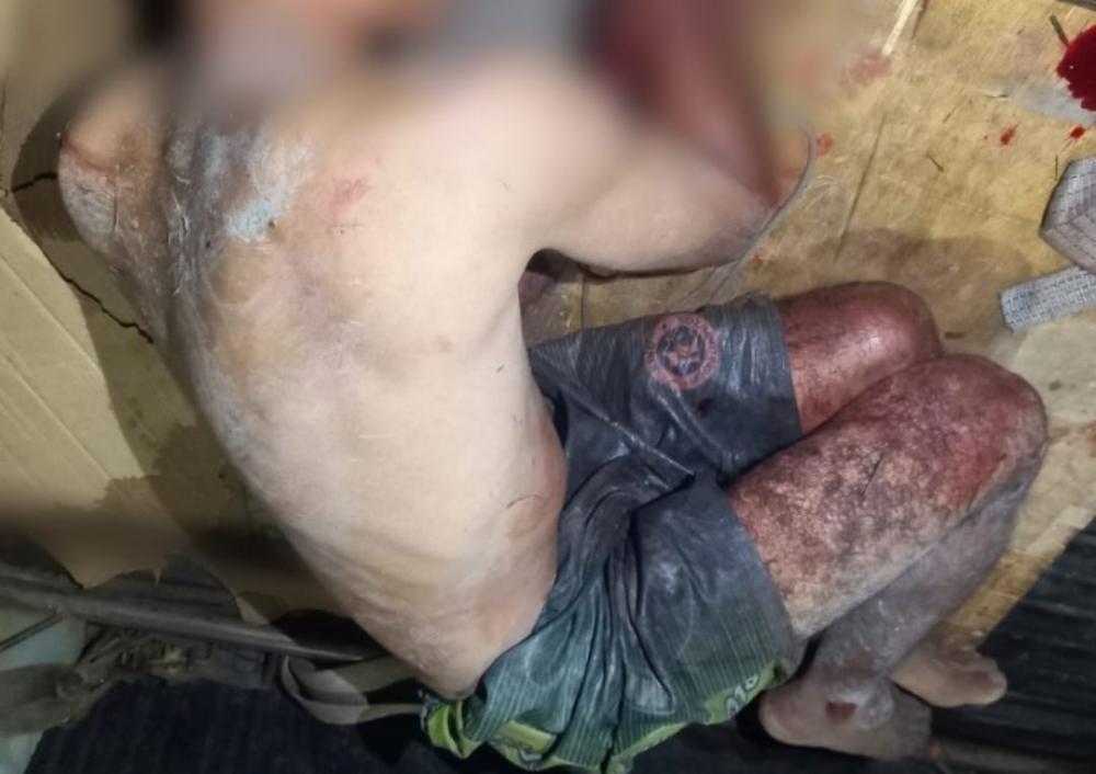 Em Manaus, homem tem mão decepada por moradores para não roubar mais