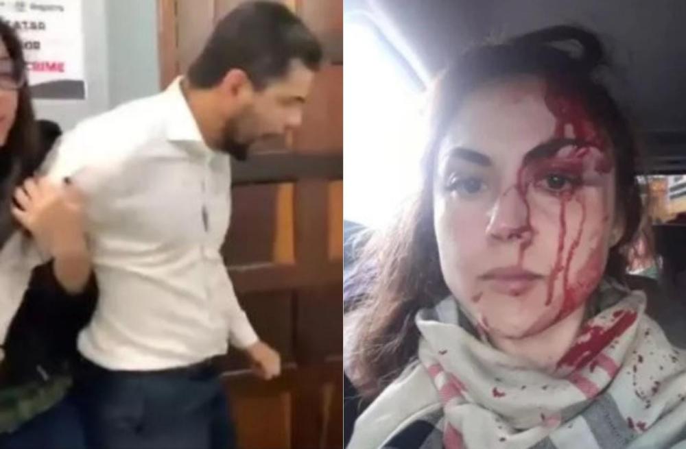 Procuradora é agredida por colega em Registro, São Paulo; confira o vídeo 