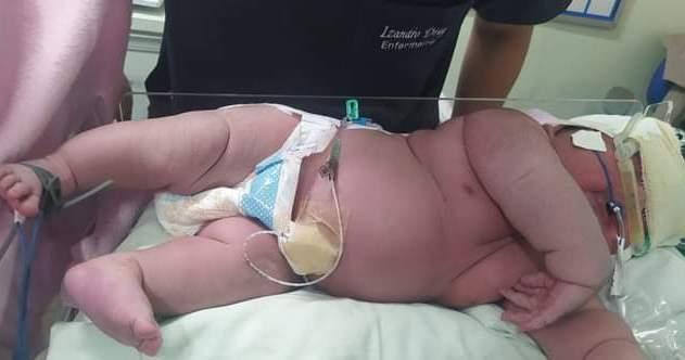 Bebê gigante nasce com mais de 7kg em Parintins, no Amazonas 
