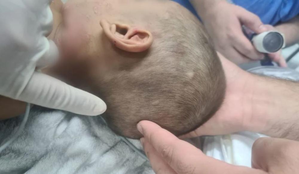 Tio é suspeito de espancar menino de 2 anos na Zona Leste de Manaus