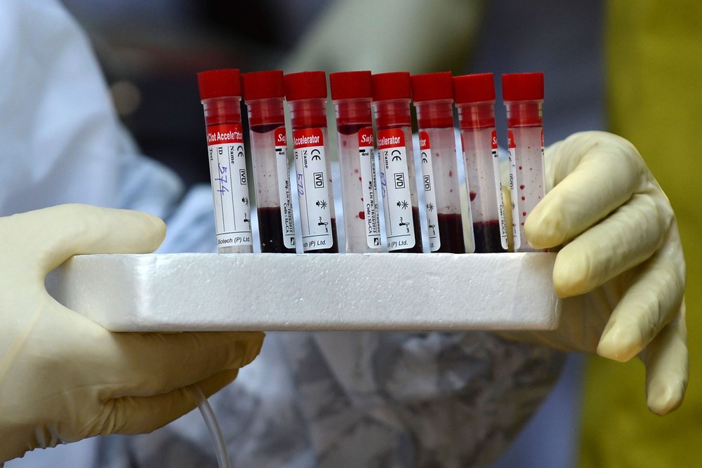 Idosa de 89 anos é 38º morte por Covid-19 no Piauí; 1.233 casos são confirmados