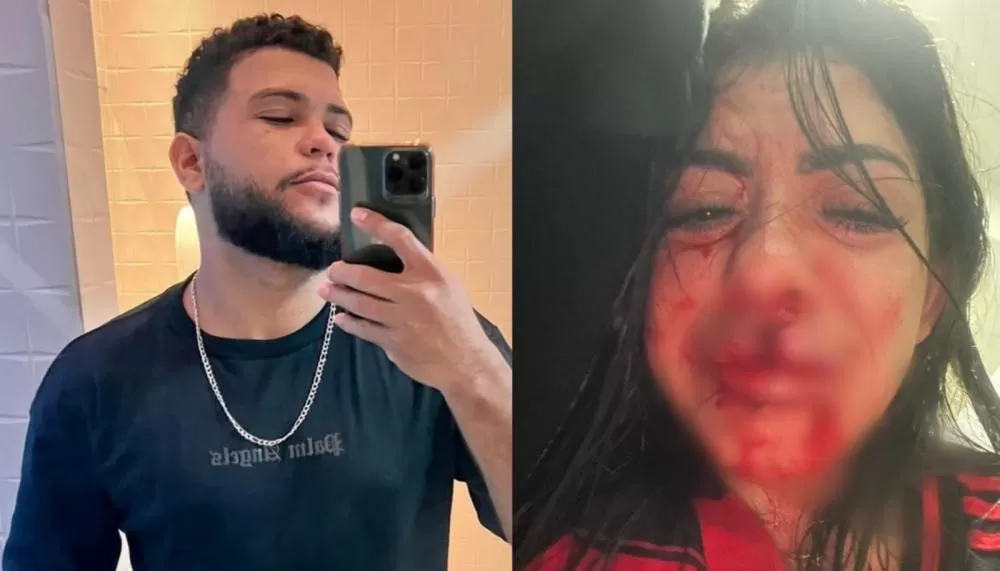 Decretada prisão preventiva do cantor que quebrou dentes da namorada durante agressão