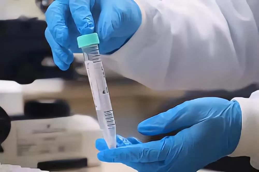 FVS registra redução de casos de mpox no Amazonas; confira dados