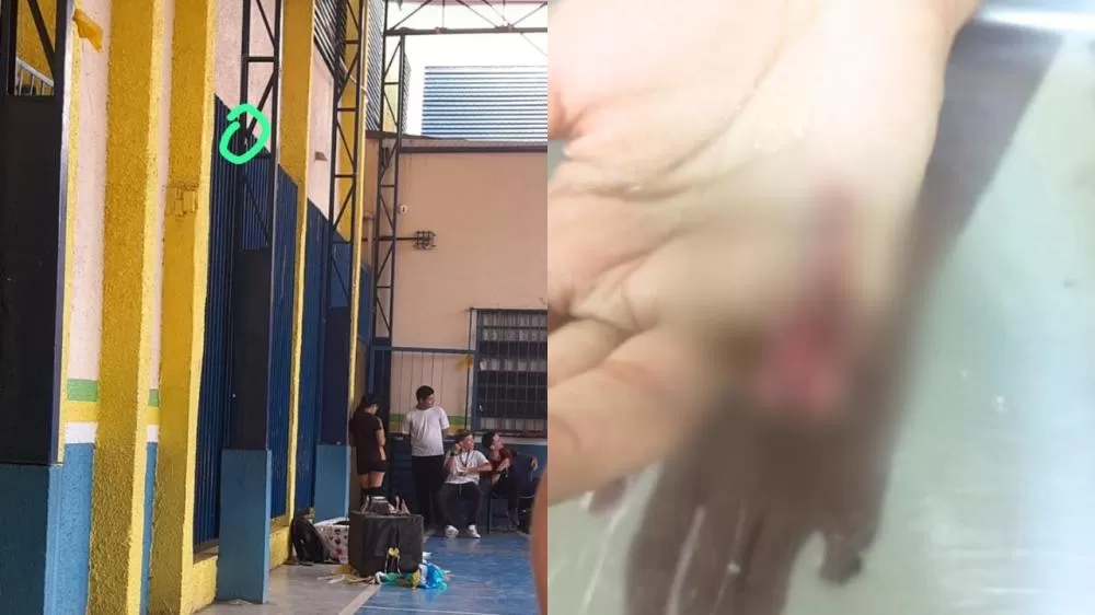 Aluno tem dedo arrancado durante acidente na quadra da escola em Manaus