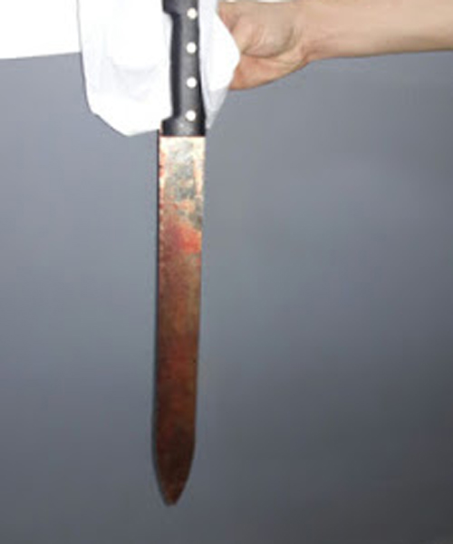 Pai fica cego após ser agredido pelo filho com golpes de terçado 