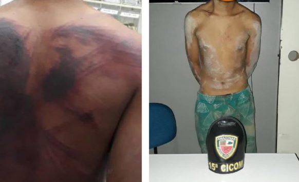 Adolescente é espancado após tentar matar seu pai com golpes de terçado na cabeça