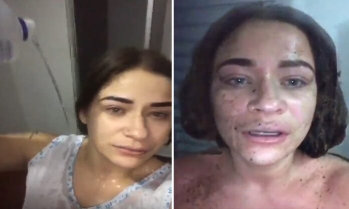 Colapso: Mulher tem surto e põe fogo no próprio corpo