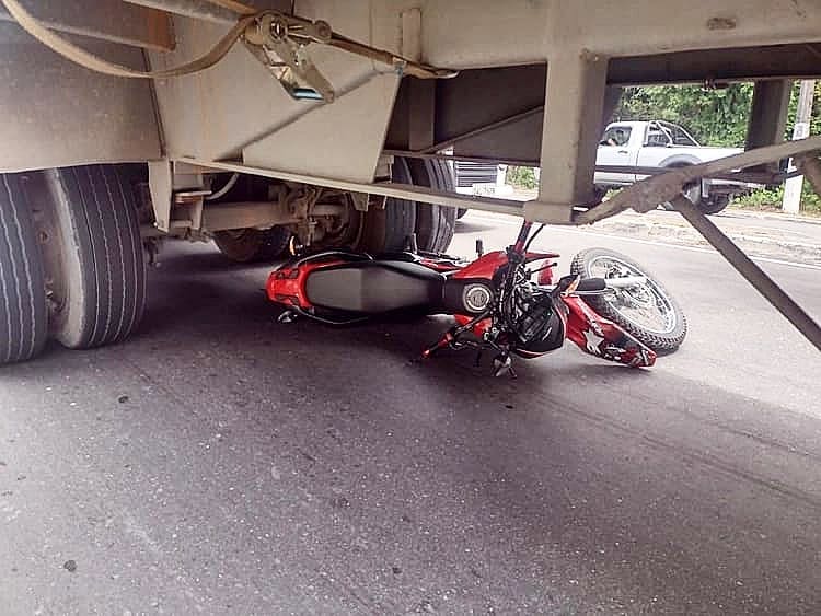 Mulher tem perna dilacerada após grave acidente de trânsito em Manaus