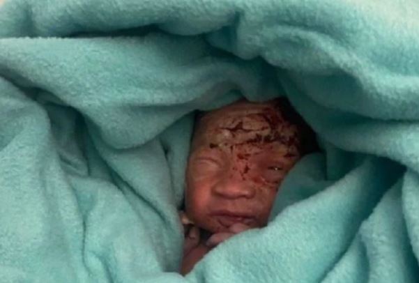 Funcionários de aeroporto encontram bebê recém-nascido em lixeira de avião